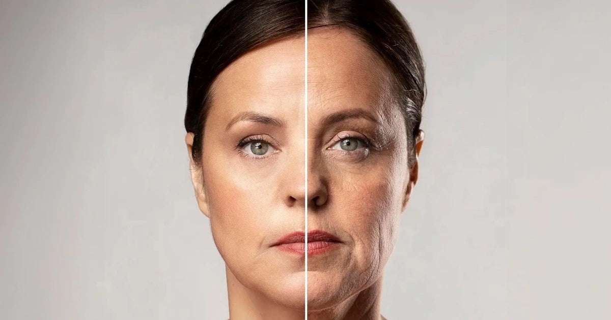 Wrinkle Remover & Neck Lift Device