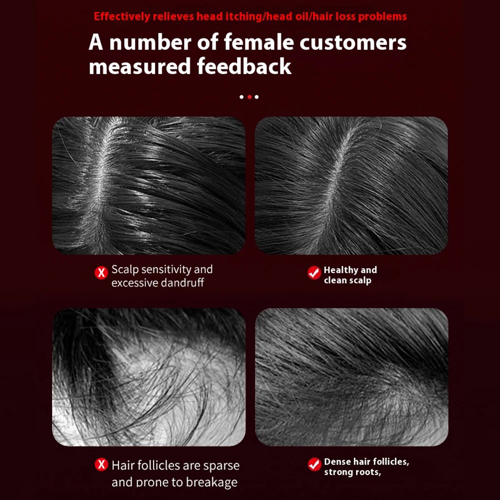 Electric Massage Comb for Hair Growth