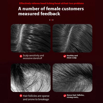 Electric Massage Comb for Hair Growth