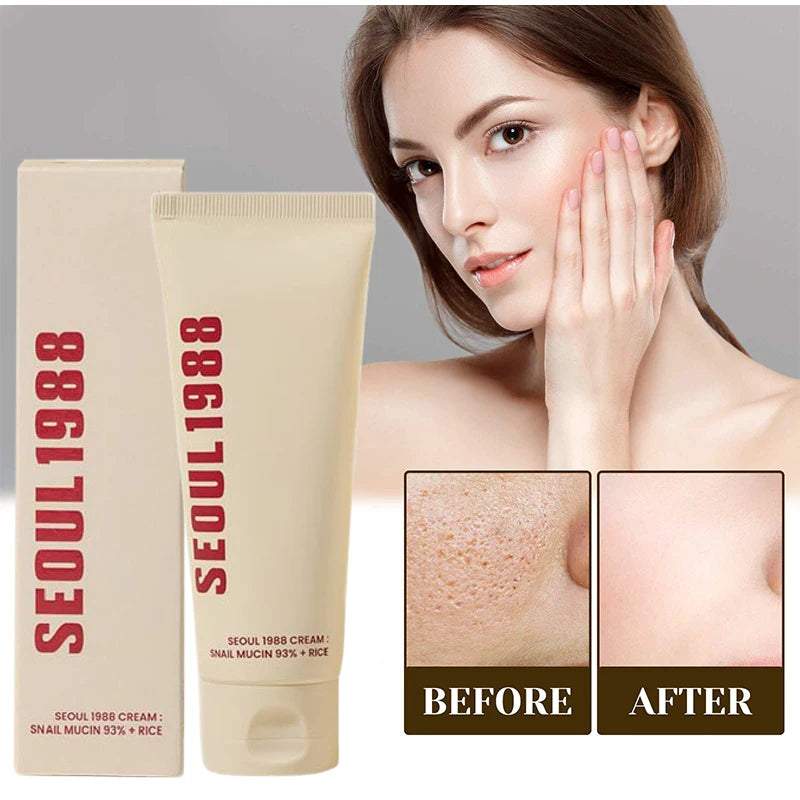 SEOUL 1988 CREAM : SNAIL MUCIN 93% + RICE