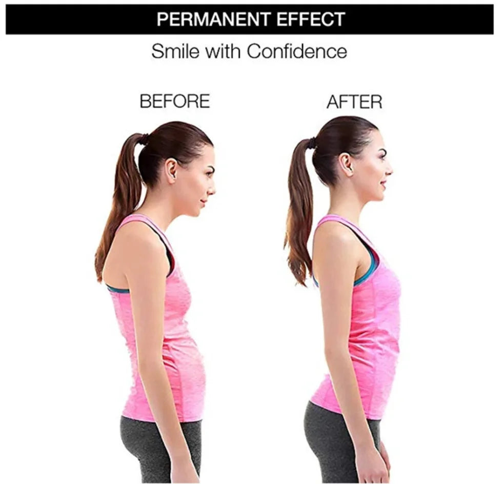 Posture Corrector Belt